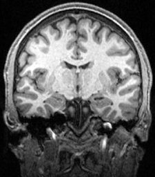 Marios Psychogios, Prof. Dr., FEBNI, FESO